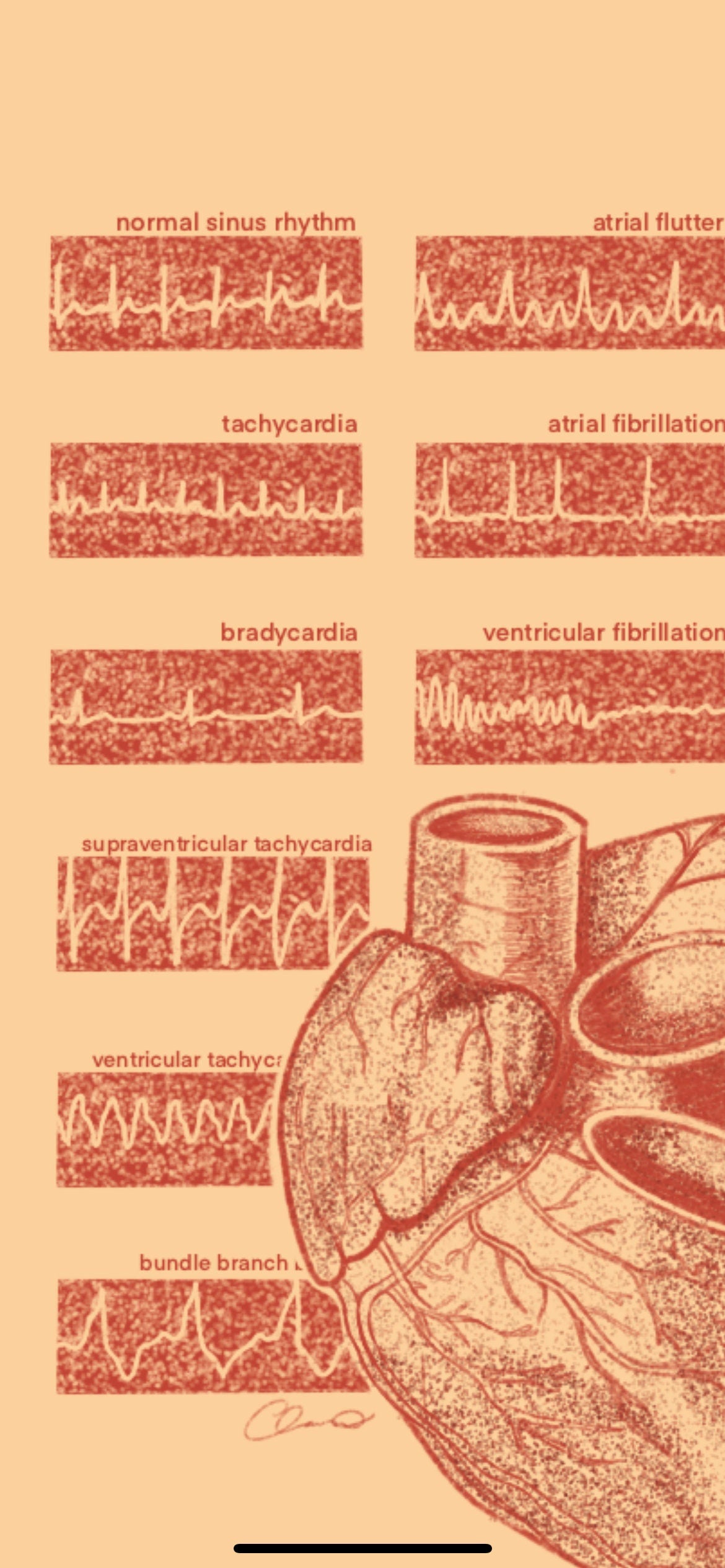 Cardiology/Heart Anatomy iPhone Wallpaper & Background (ORANGE/BEIGE BACKGROUND)