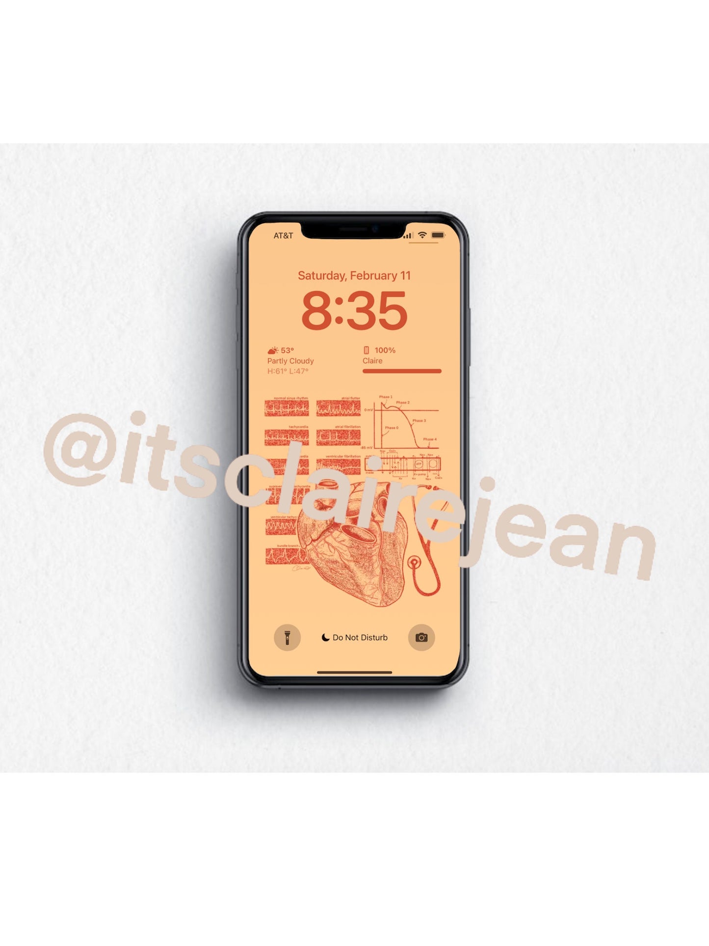 Cardiology/Heart Anatomy iPhone Wallpaper & Background (ORANGE/BEIGE BACKGROUND)