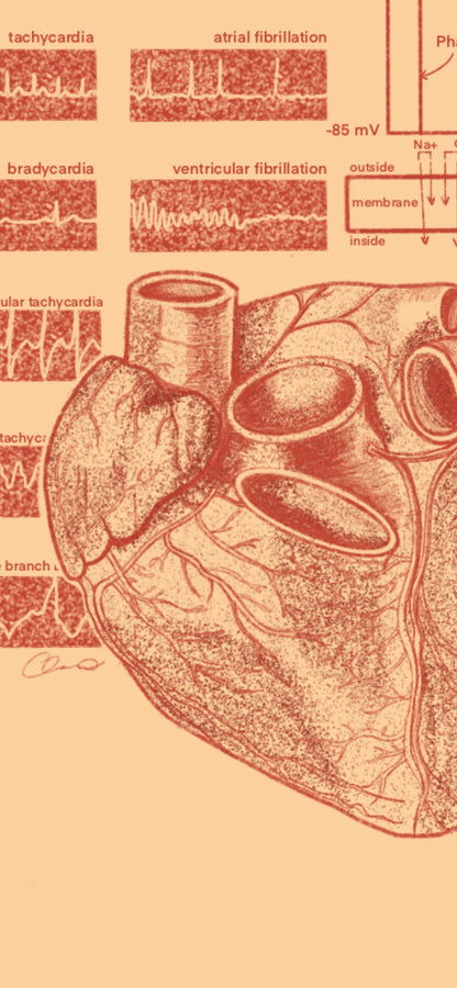 Cardiology/Heart Anatomy iPhone Wallpaper & Background (ORANGE/BEIGE BACKGROUND)